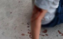 Tiêu huỷ con chó cắn du khách nước ngoài ở Nha Trang