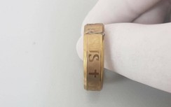 Suýt mất dương vật vì đeo nhẫn để tạo cảm giác lạ
