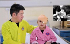 Xót xa bé trai 4 tuổi bị u “quái” khủng đẩy mắt lồi ra phía trước