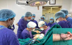 8 giờ căng thẳng nối lại bàn tay bị đứt rời cho bé trai 21 tháng tuổi