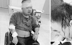 Đã xác định một số đối tượng chém người đi đường ở Hà Nội