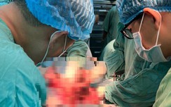 Các bác sĩ đã nỗ lực cấp cứu chủ tịch phường ở Huế bị đâm gục thế nào?