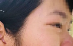 Con hạnh kiểm trung bình, thầy giáo đánh cô giáo: Tỉnh chỉ đạo khẩn