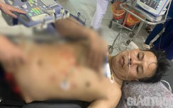 Nghi mâu thuẫn do ghen tuông, người đàn ông đâm chết người tình rồi tự sát
