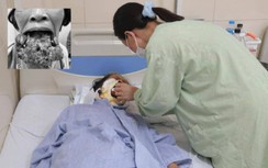 Tin vào thực dưỡng, một phụ nữ để phát triển khối u môi khổng lồ