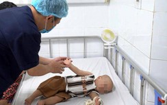 Khan hiếm thuốc cho trẻ mắc bệnh tay chân miệng biến chứng thần kinh