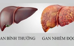 Có cần thiết phải giải độc gan?