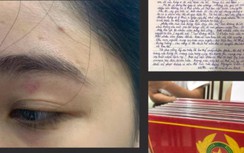 Hà Nội: Nhân viên quán bánh mì Nguyên Sinh bị tố hành hung khách hàng