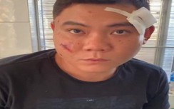 Danh tính kẻ nổ súng khiến bố và anh trai người yêu bị thương nặng