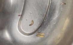 Bệnh nhân đau nhức, ù tai, bác sĩ phát hiện ổ giòi lúc nhúc trong tai