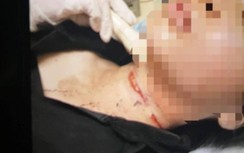 Người phụ nữ mua dao tự cắt cổ rồi bịa đặt bị cướp