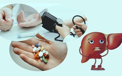 Mắc tiểu đường có cần dùng thuốc bổ gan?
