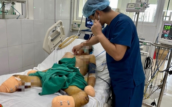 Thích ăn nem chạo, thịt lợn sống, người đàn ông nguy kịch vì nhiễm khuẩn liên cầu lợn
