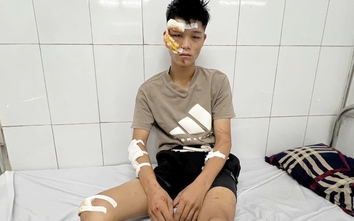 Điều tra tội giết người với "quái xế" lao xe vào cảnh sát cơ động