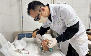 Liên tiếp nhiều ca nát tay, bỏng mặt vì pháo nổ