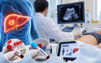 Cần làm gì để phát hiện sớm ung thư gan?