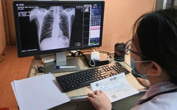 Phòng và điều trị sớm để lao không thành gánh nặng bệnh tật