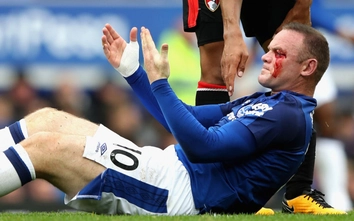 Cựu đội trưởng M.U chảy máu đầm đìa sau khi “ăn đòn” trên sân