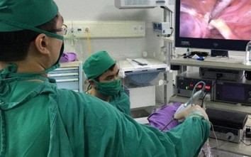 Vòng tránh thai "lạc trôi" trong ổ bụng người phụ nữ 63 tuổi