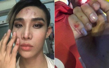 Hé lộ nguyên nhân vụ người mẫu The Face tố bị tài xế Go - Viet đánh