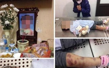 Chủ tịch Hà Nội chỉ đạo điều tra vụ cháu bé 3 tuổi nghi bị bạo hành tử vong