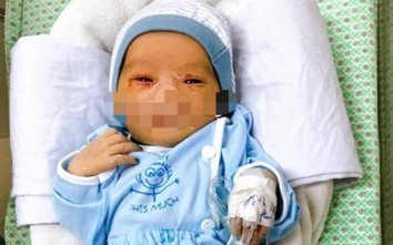 Sau 17 ngày điều trị, sức khỏe bé trai bị bỏ rơi ngoài nắng nóng ra sao?