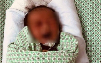 Bé trai bị bỏ rơi 3 ngày nhiễm trùng máu nặng, được 2 BV điều trị tích cực