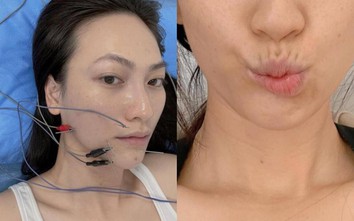 Phương Anh Đào bị méo miệng vì chữa căn bệnh giống hoa hậu Phạm Hương