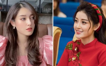 Á hậu Huyền My gây "sửng sốt" với chiếc mũi lạ lẫm "sượng trân"