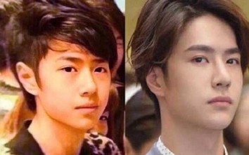 Vương Nhất Bác bị bác sĩ phẫu thuật thẩm mỹ "gọi tên"