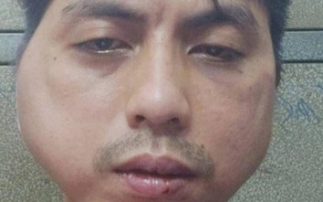 Công an vào cuộc vụ nhân viên xin nghỉ việc bị chủ quán lẩu nướng hành hung