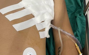 20 côn đồ truy sát đâm chém khiến một thanh niên trọng thương