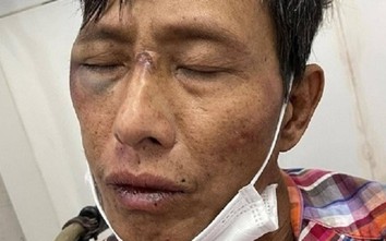 Bị vây bắt sau khi gây án, kẻ nhiễm HIV vác rìu, dao chém 2 công an